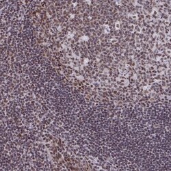 YTHDF2 Antibody, Novus Biologicals 0.1mL; Unlabeled:Antibodies, Polyclonal